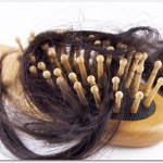 脱毛症の女性の原因はアレルギーが関係している？円形脱毛症は金属アレルギーが原因である可能性が高いそうです